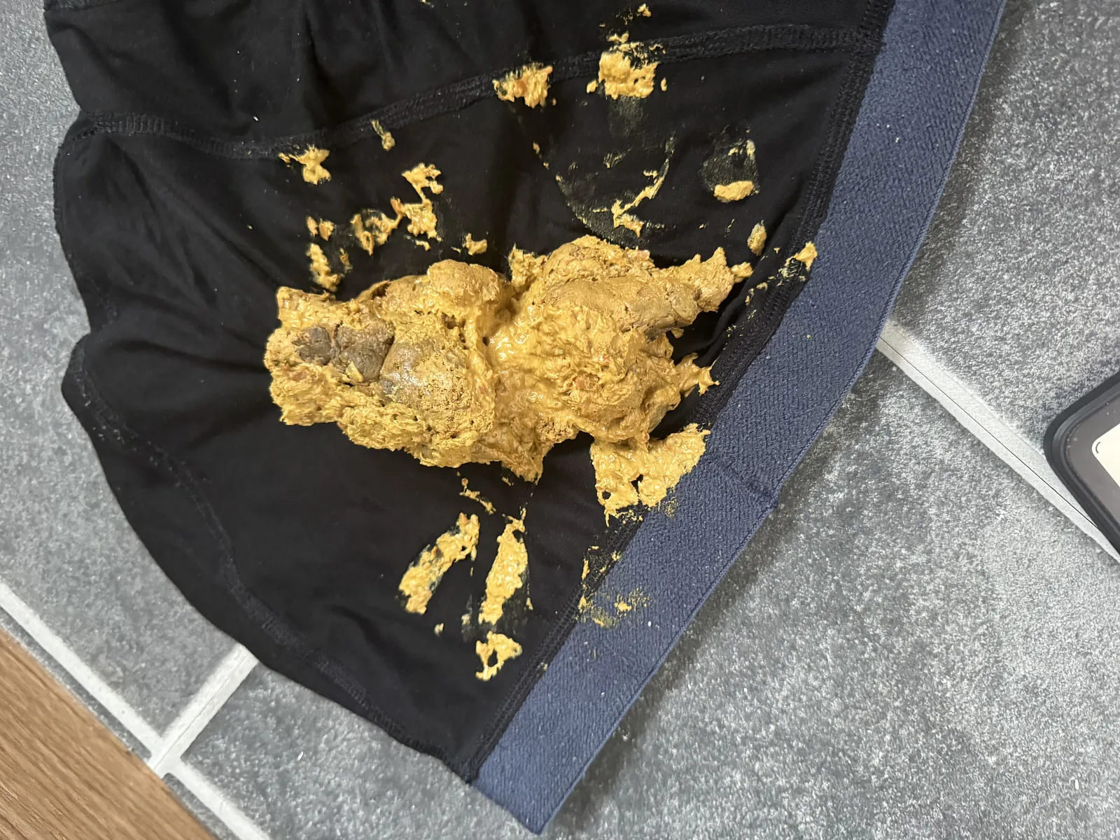 Poop