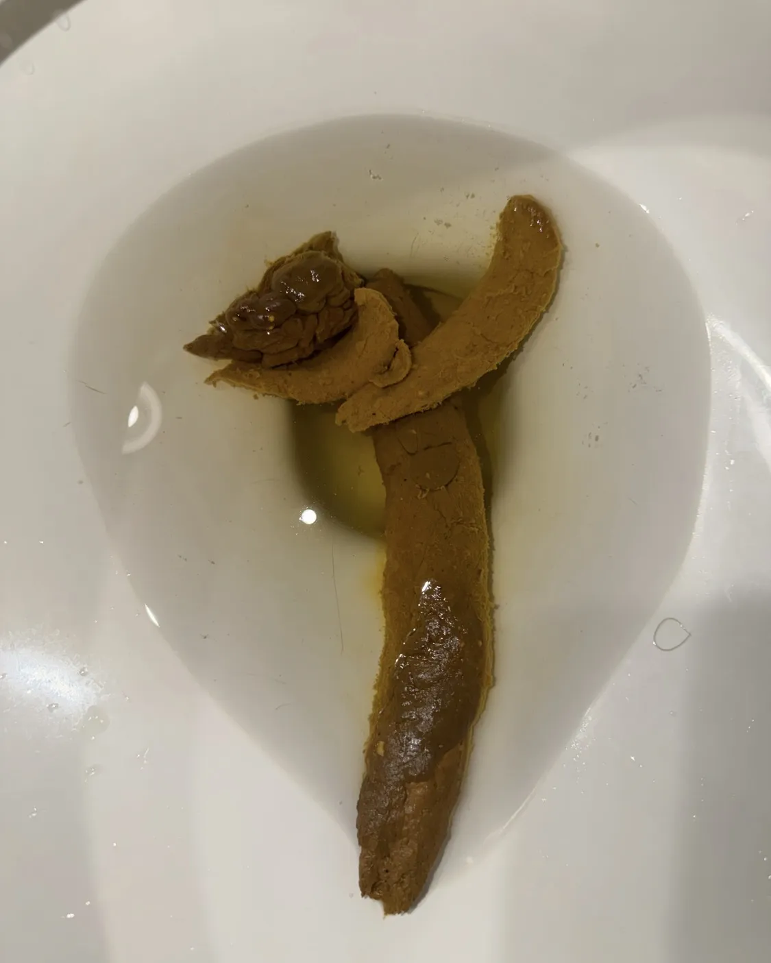 Huge poop