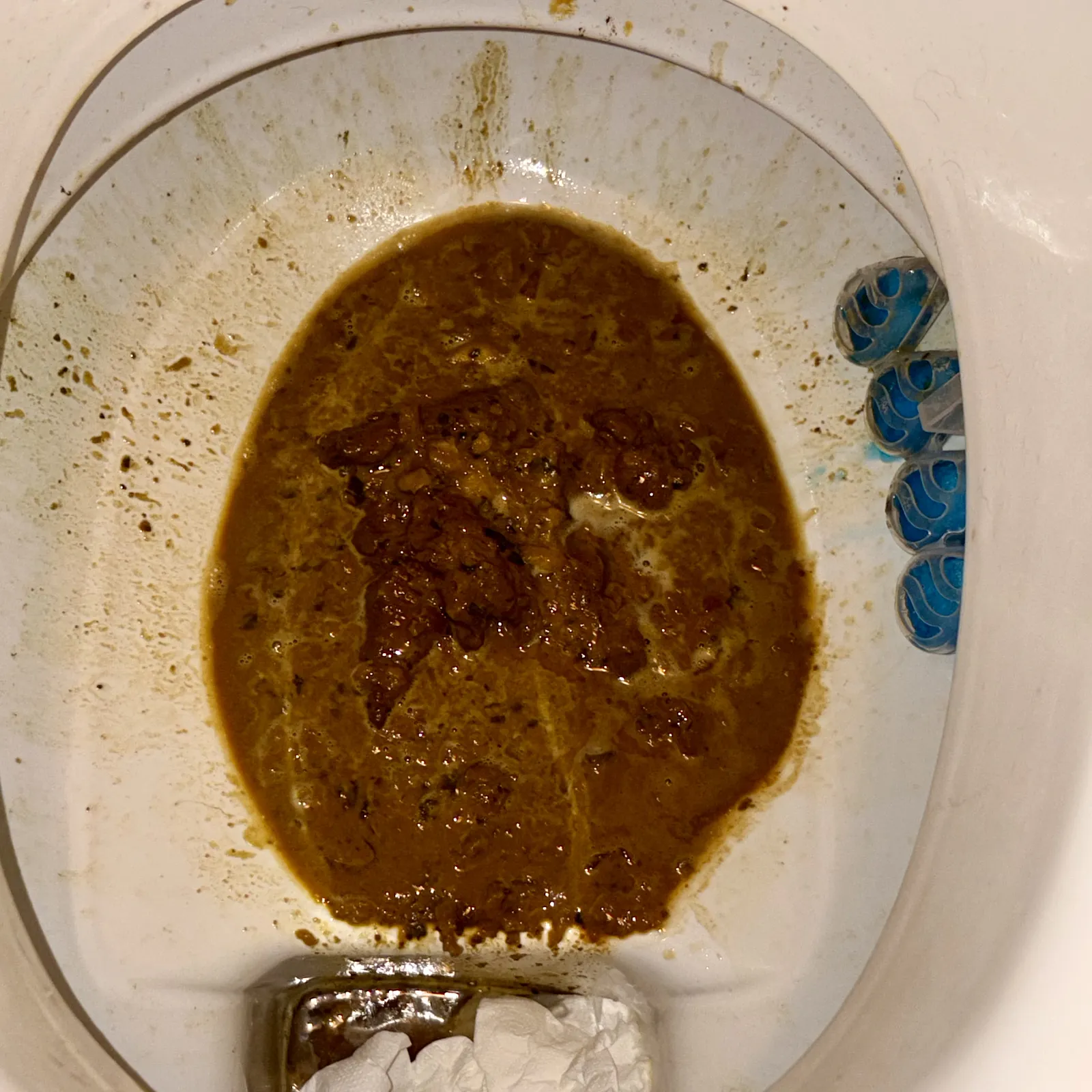 Poop explosion