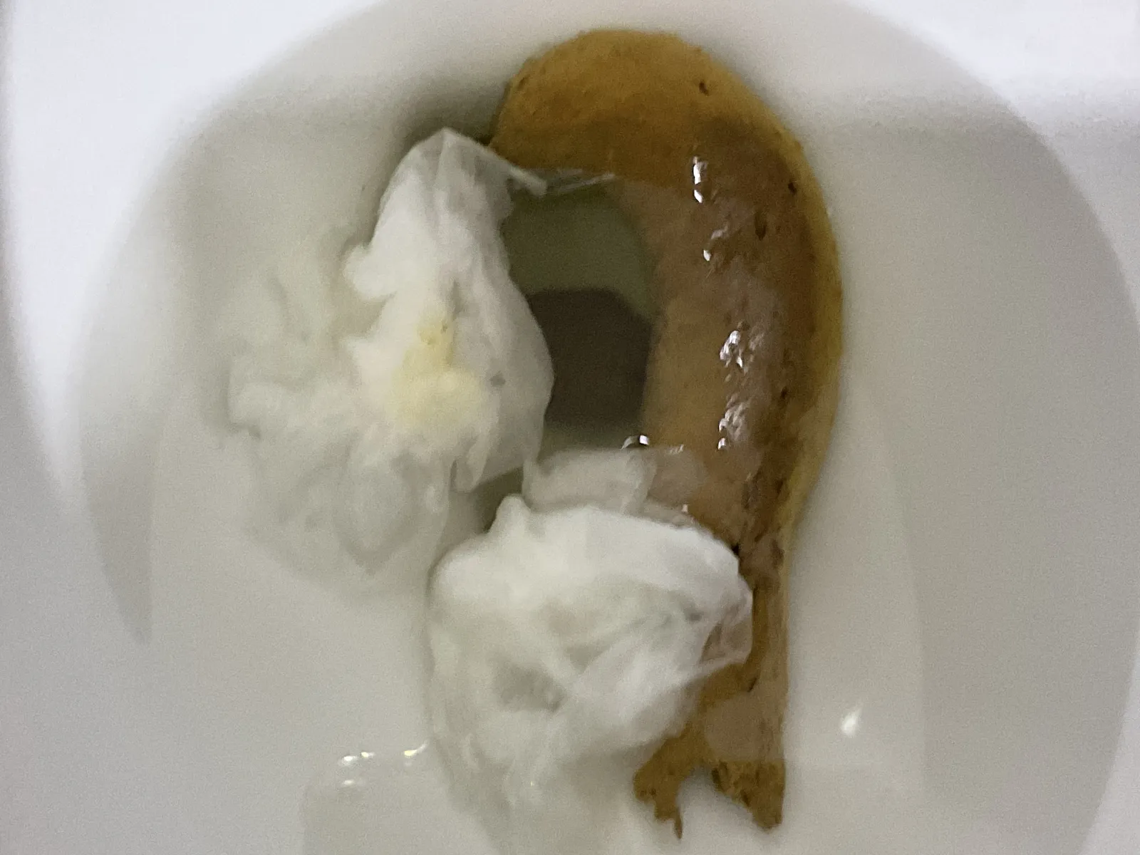 I had diarrhea the next 2 secs after ts???