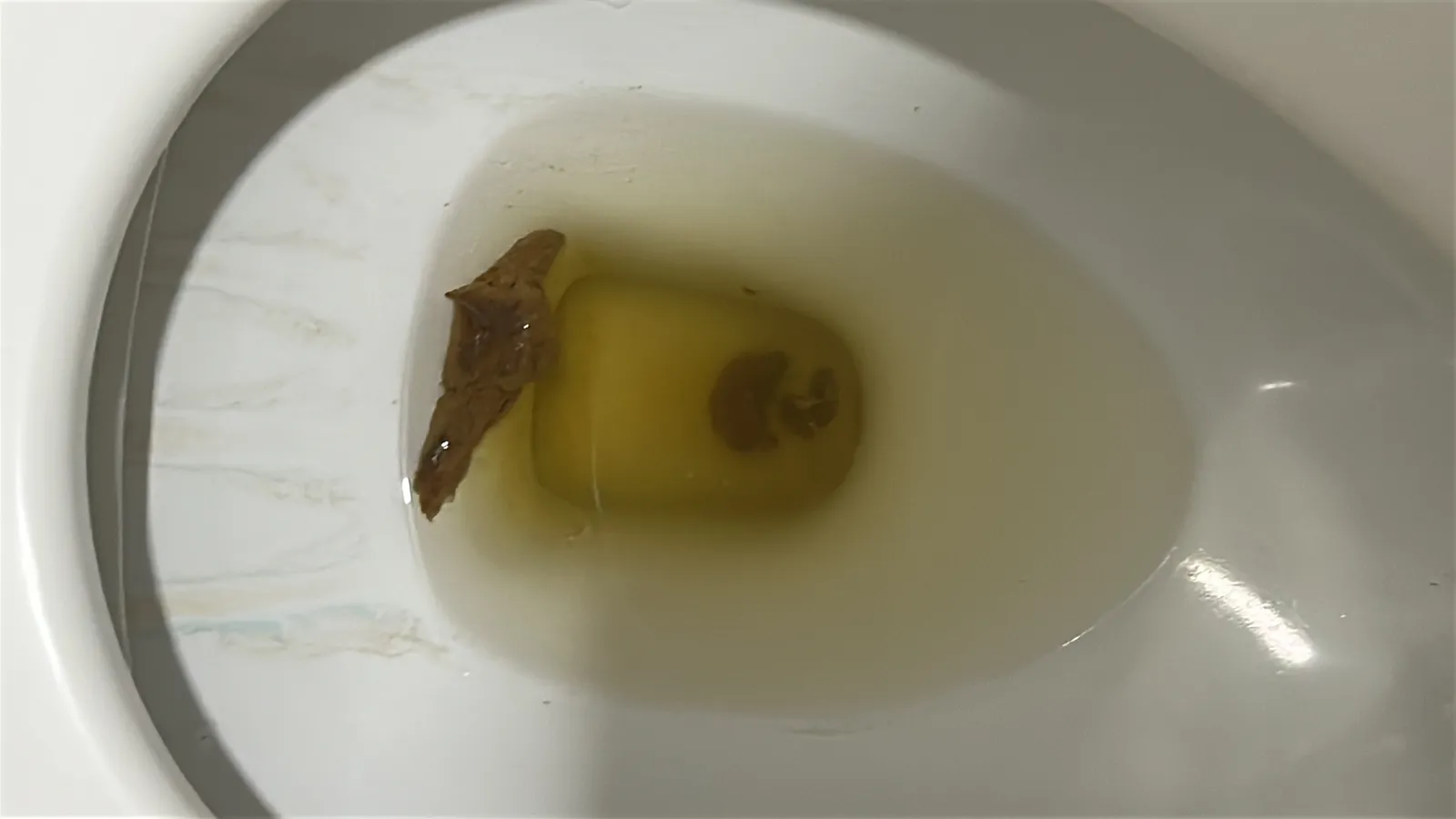 baby poo