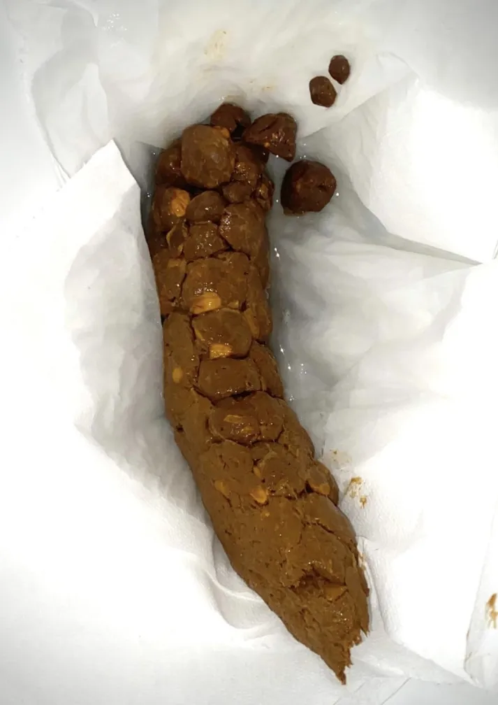 Corn on the….poop
