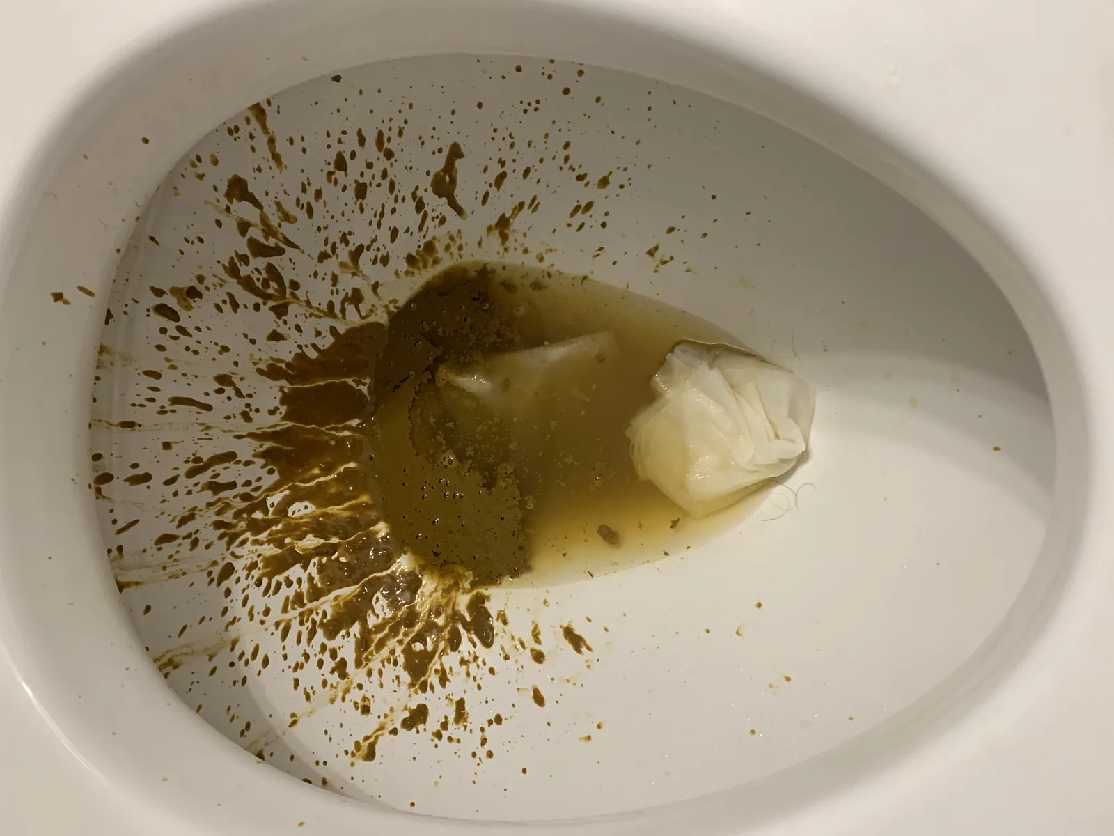 Vincent Van Poo?
