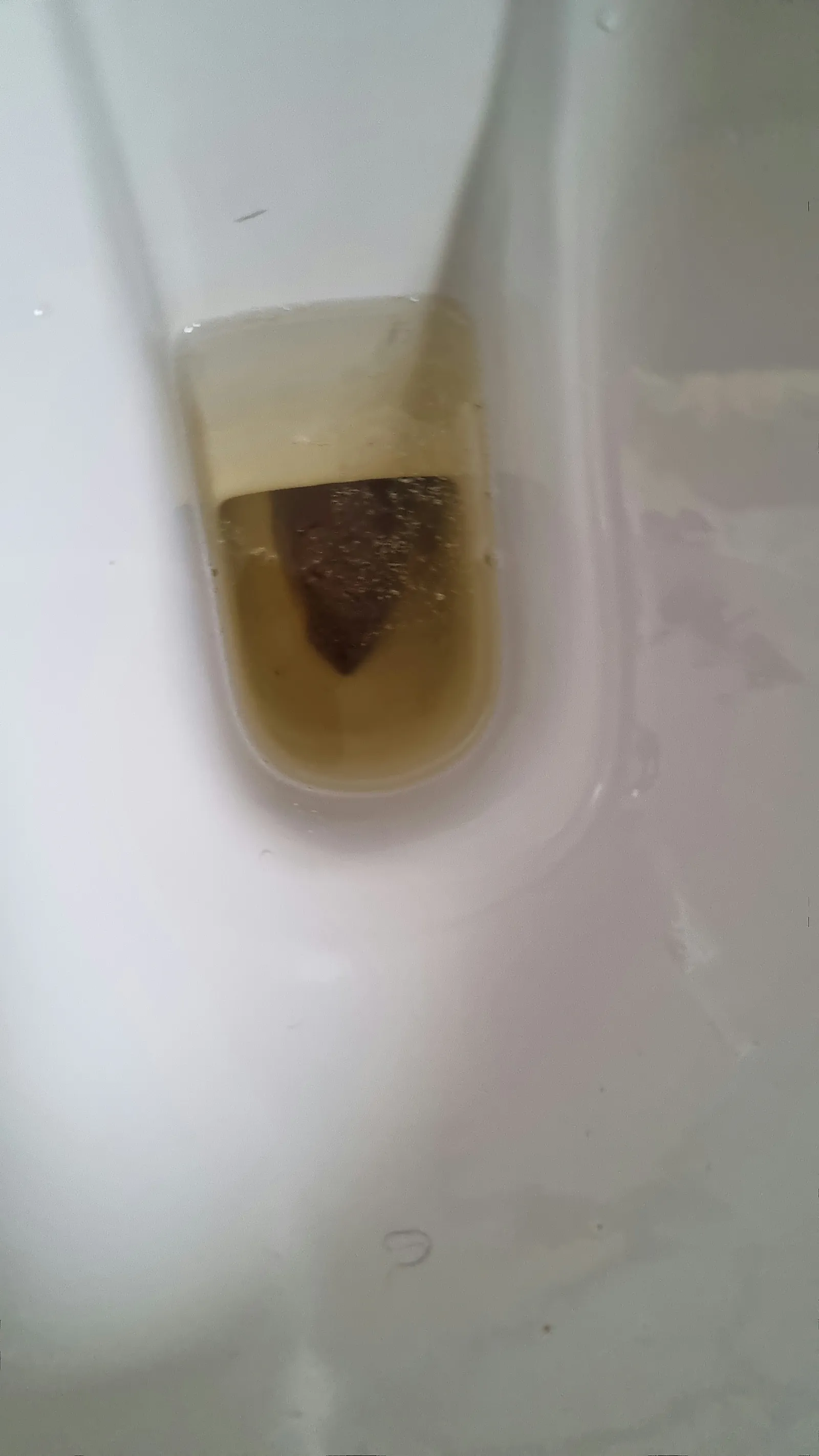 normal poop