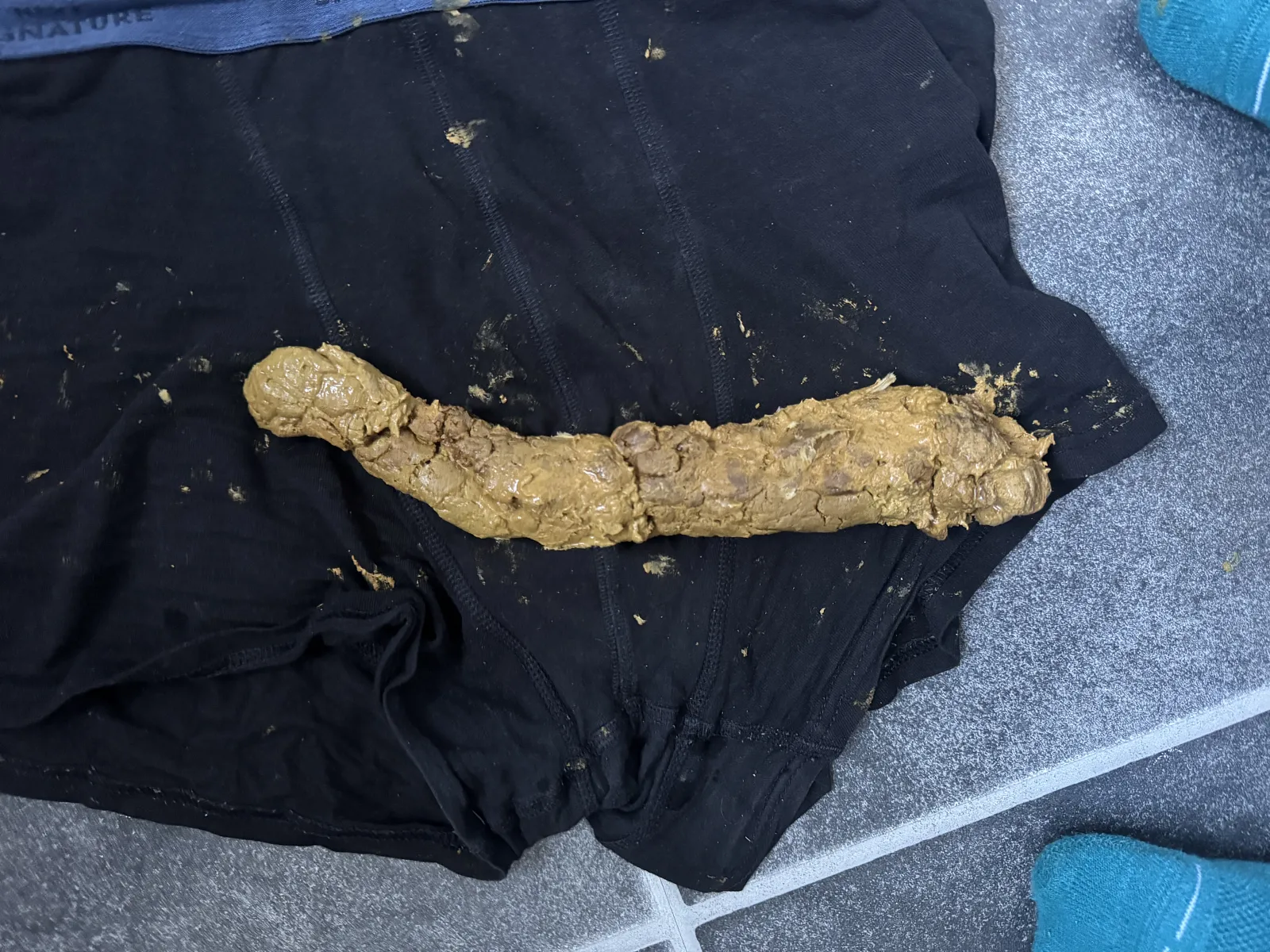 Poop