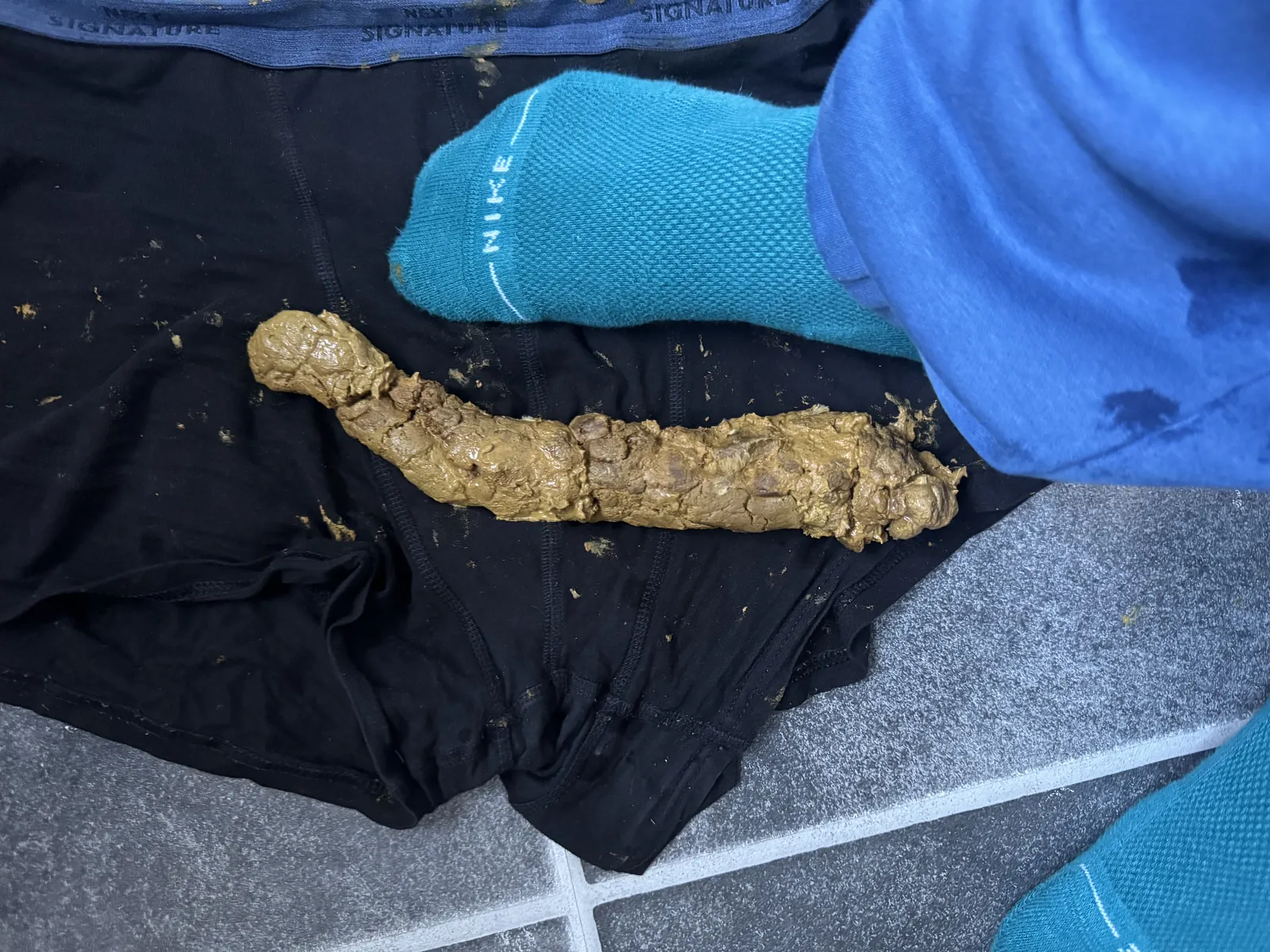 Poop 5 day