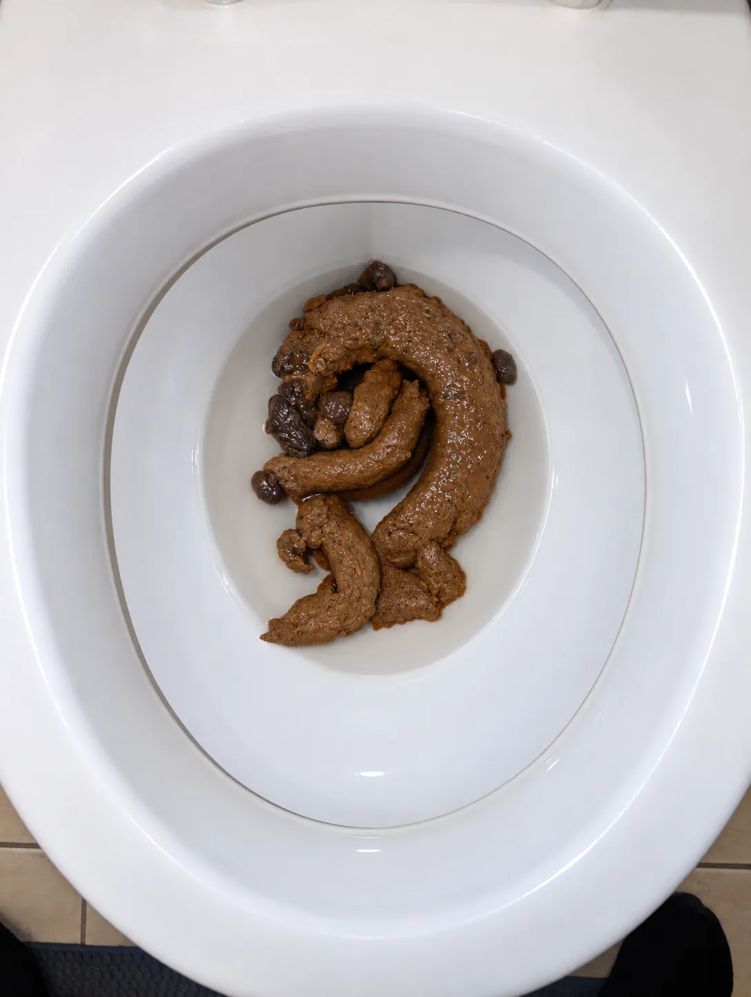 Pooping a lots of Poop