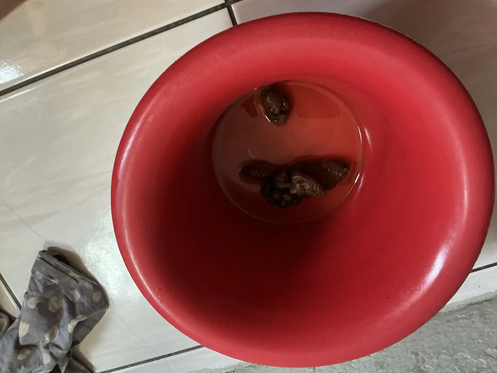 Baby poop