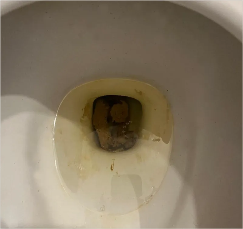 Poop!