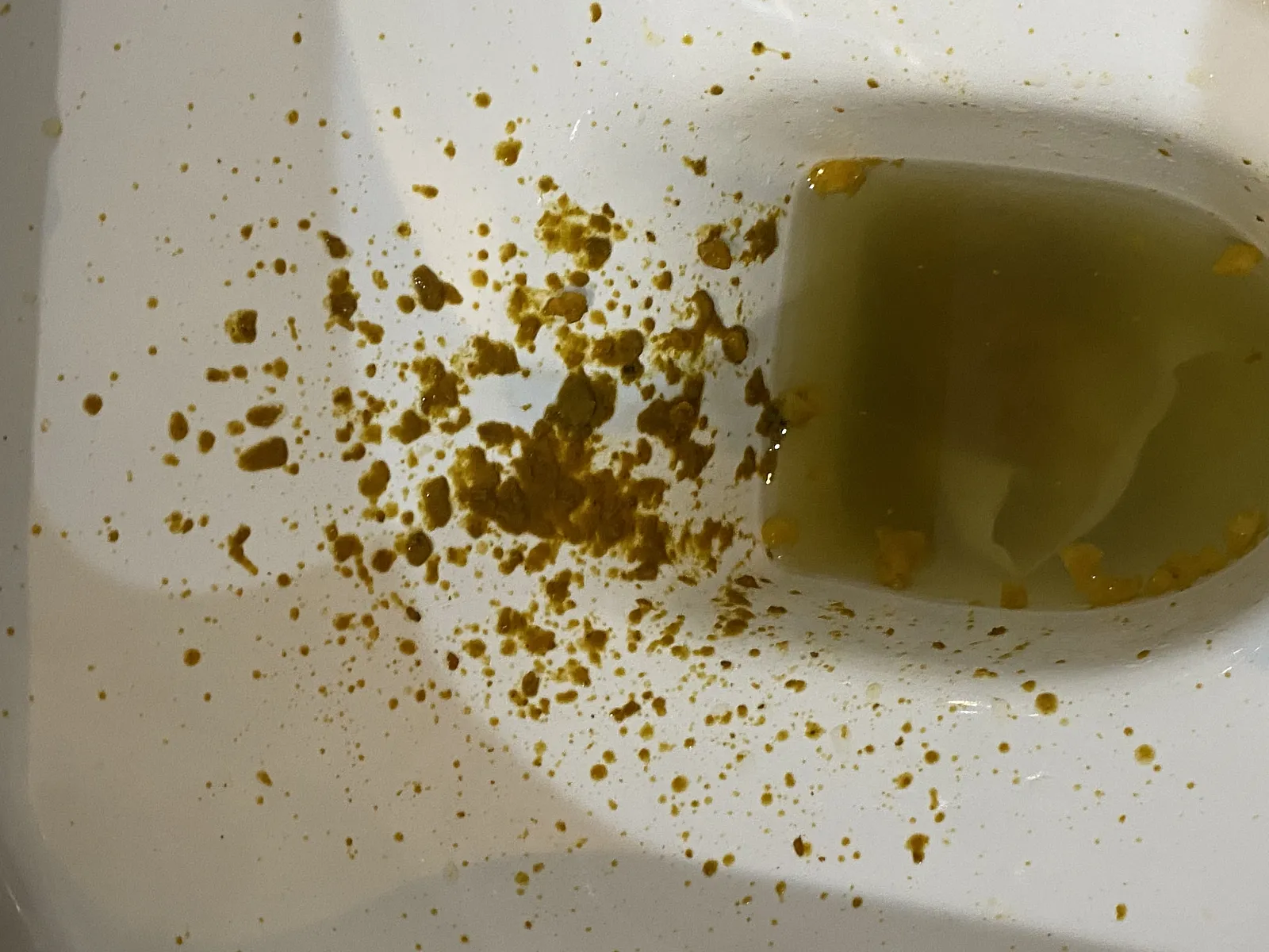 Flu poo