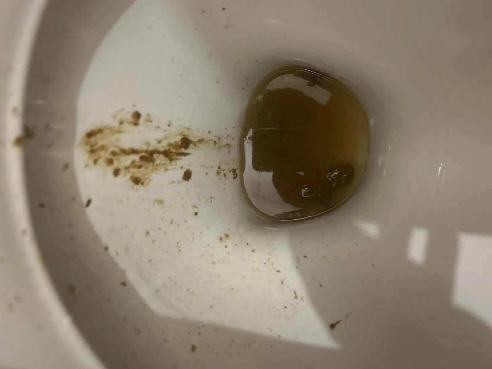 Poo