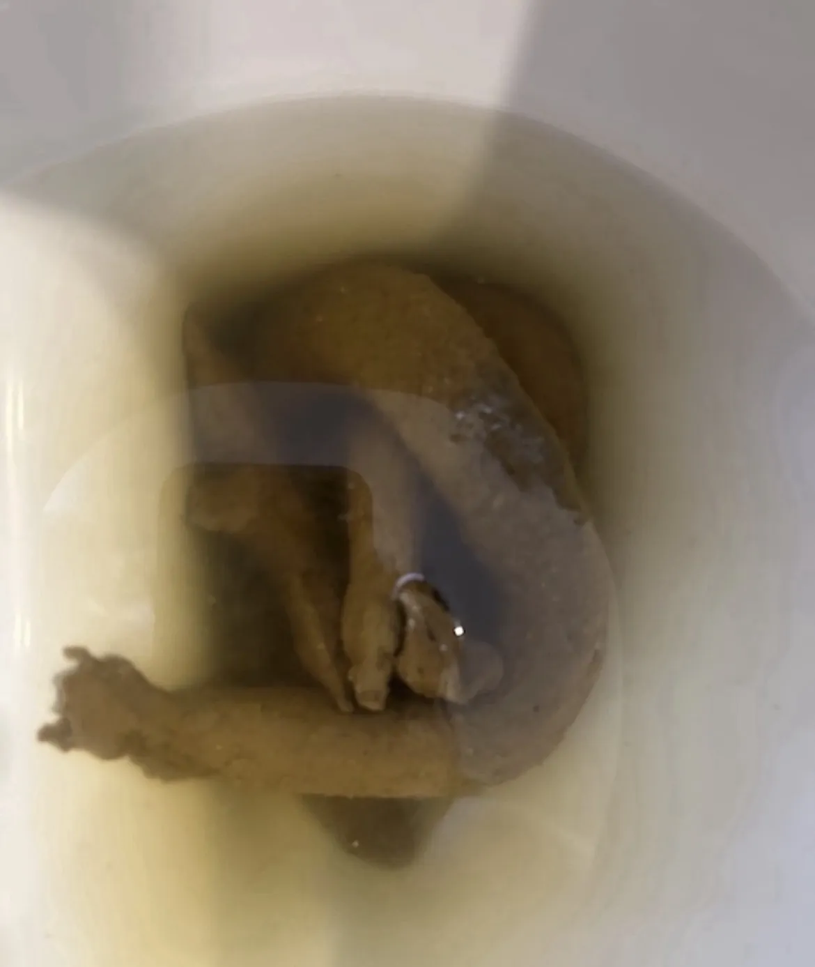 Anaconda 2