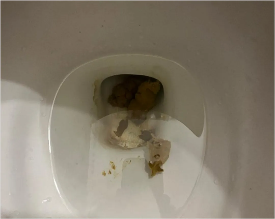 Small and messy poo