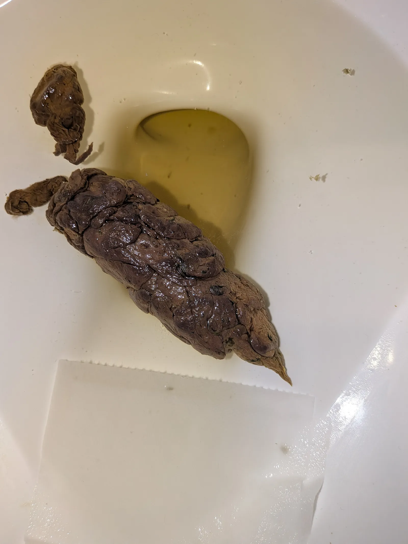 ?️ shaped shit