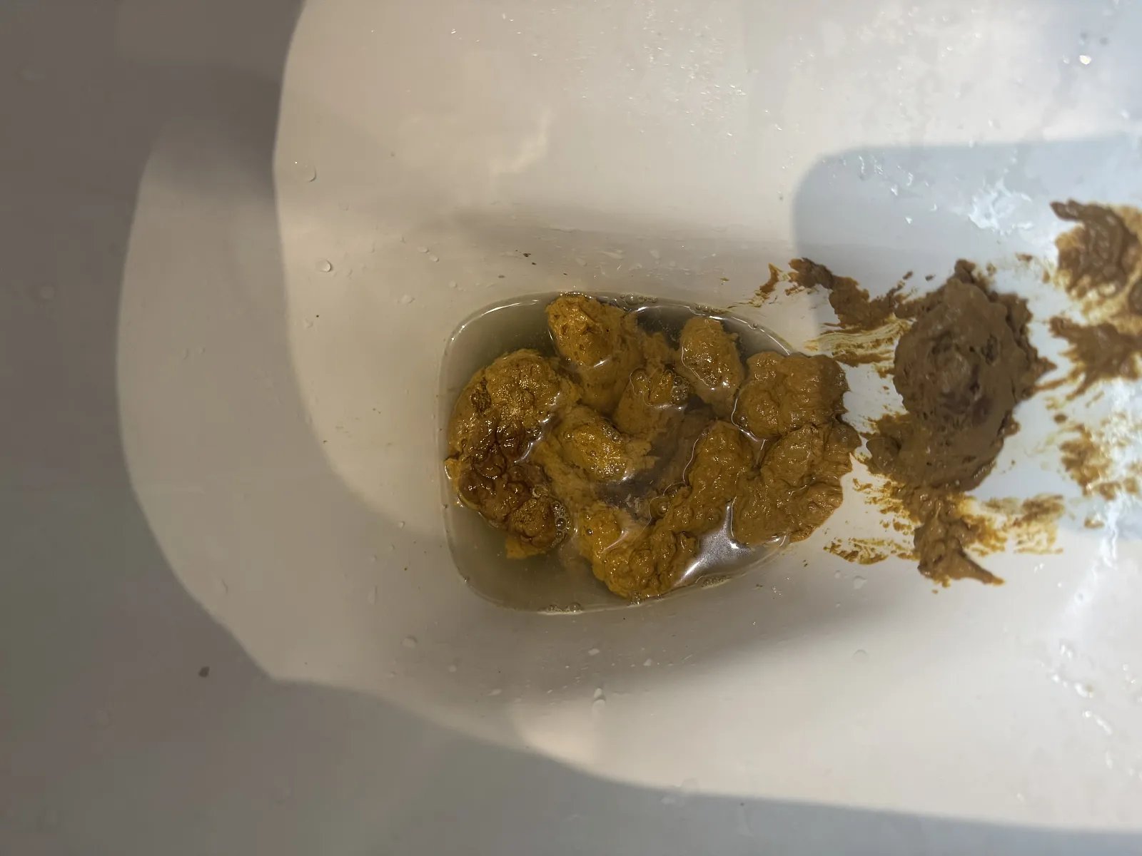 Poop
