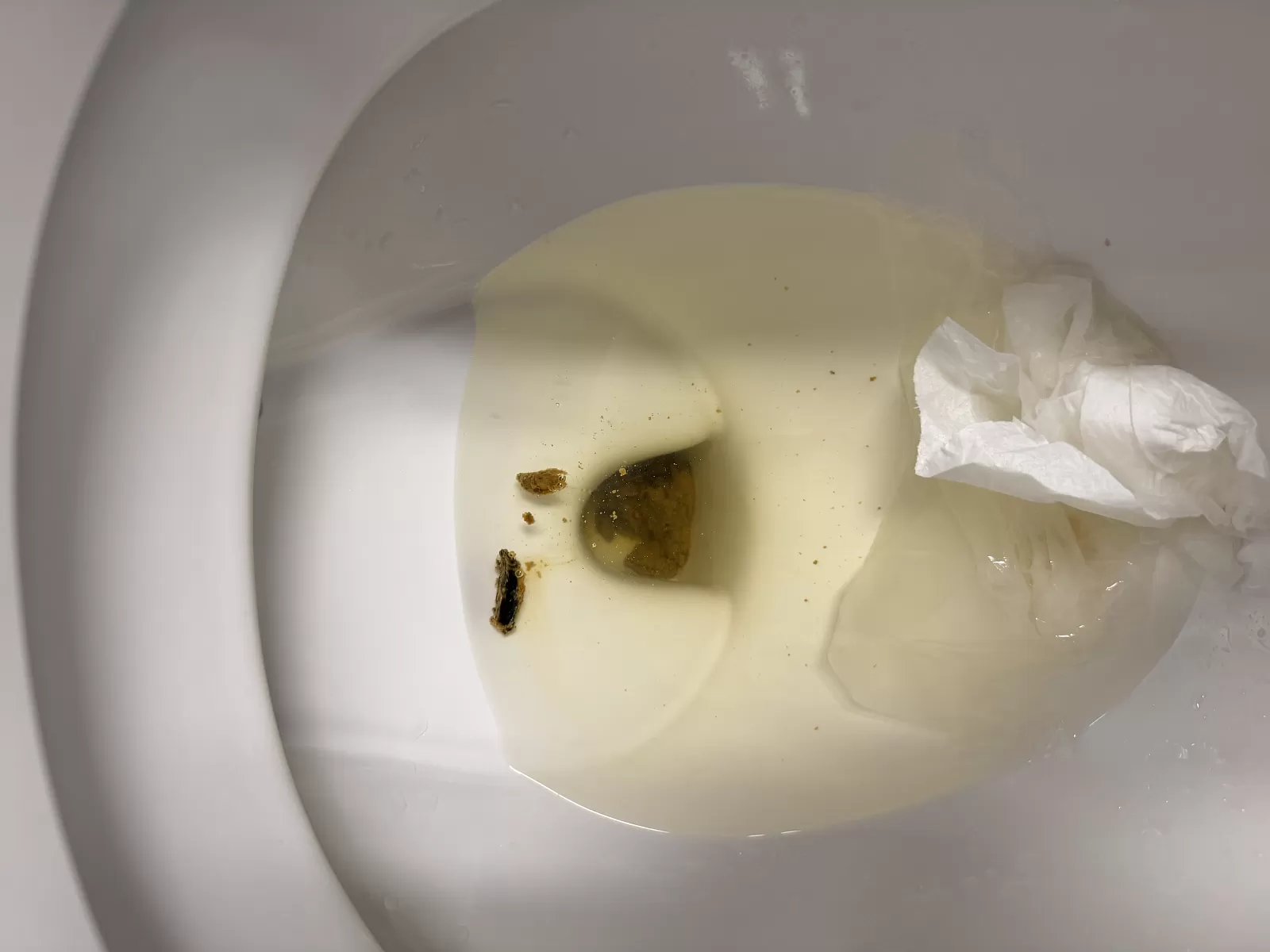 What’s in my poop