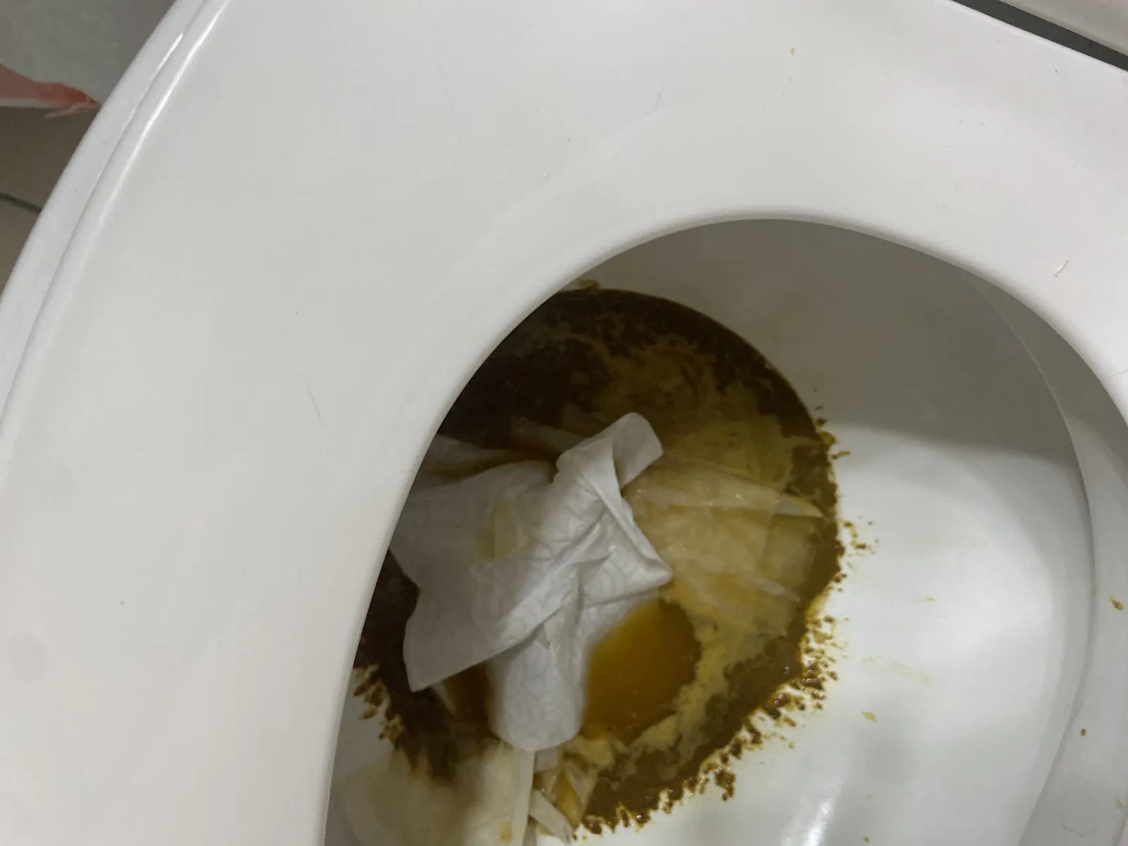 The Splatter