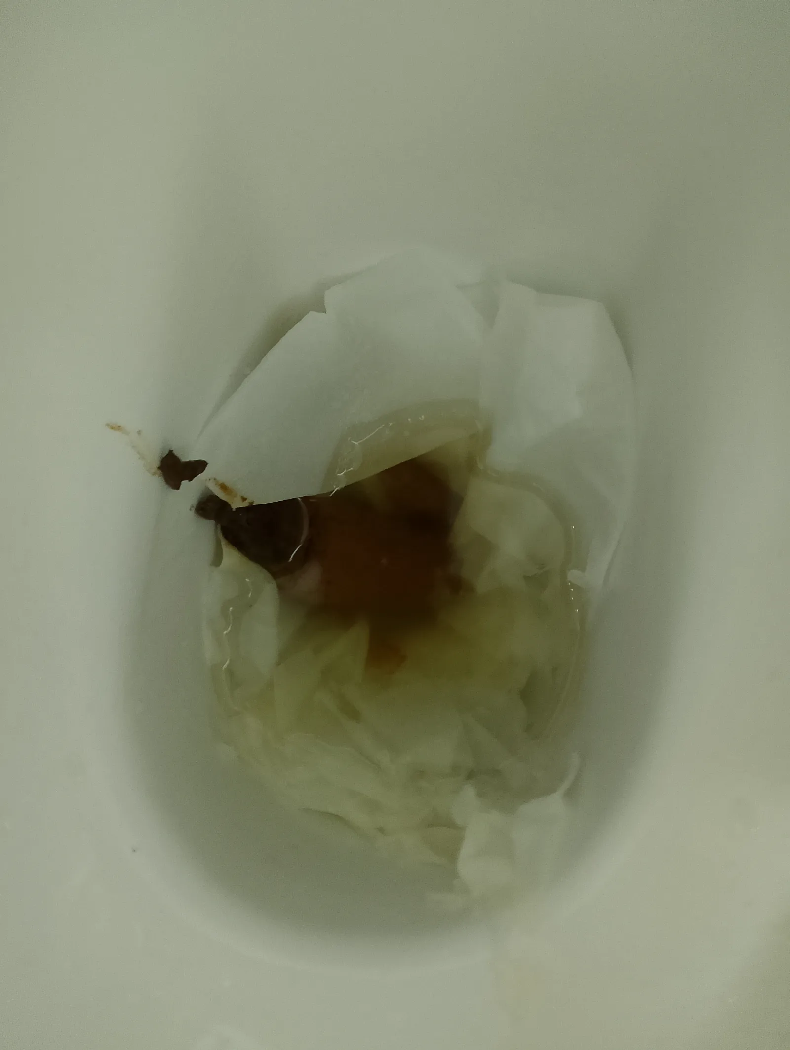 Poop with toilet paper