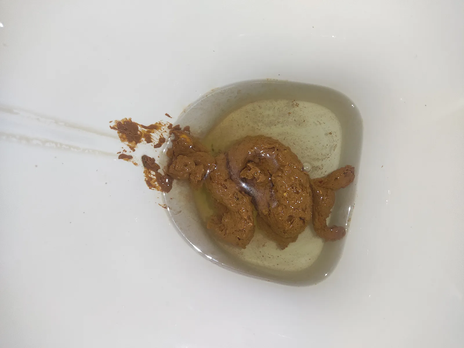 diarrhea and piss