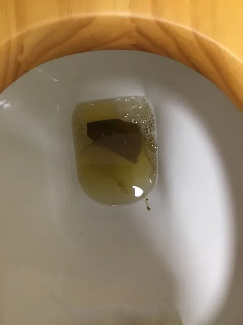 Was Dying for a mornings poo