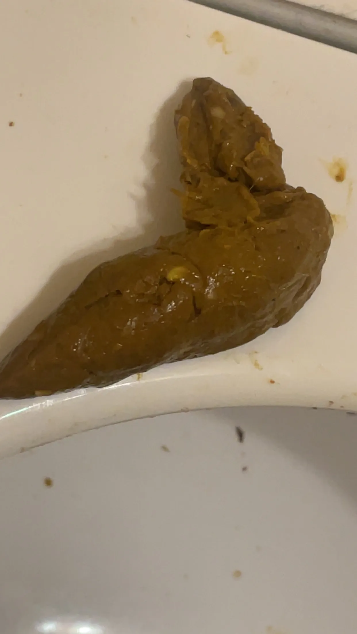 Do I have a tapeworm are is this just food particles