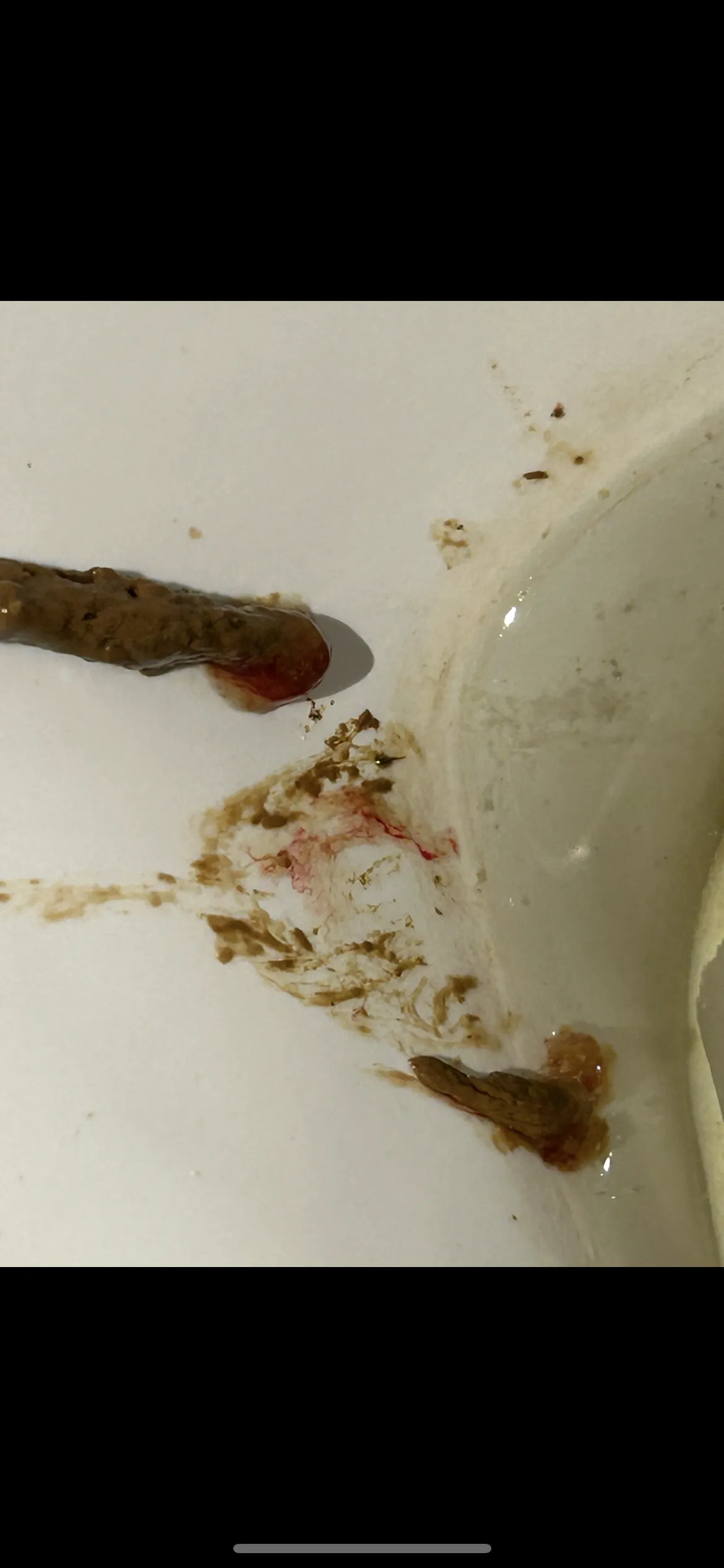 Bloody great poo