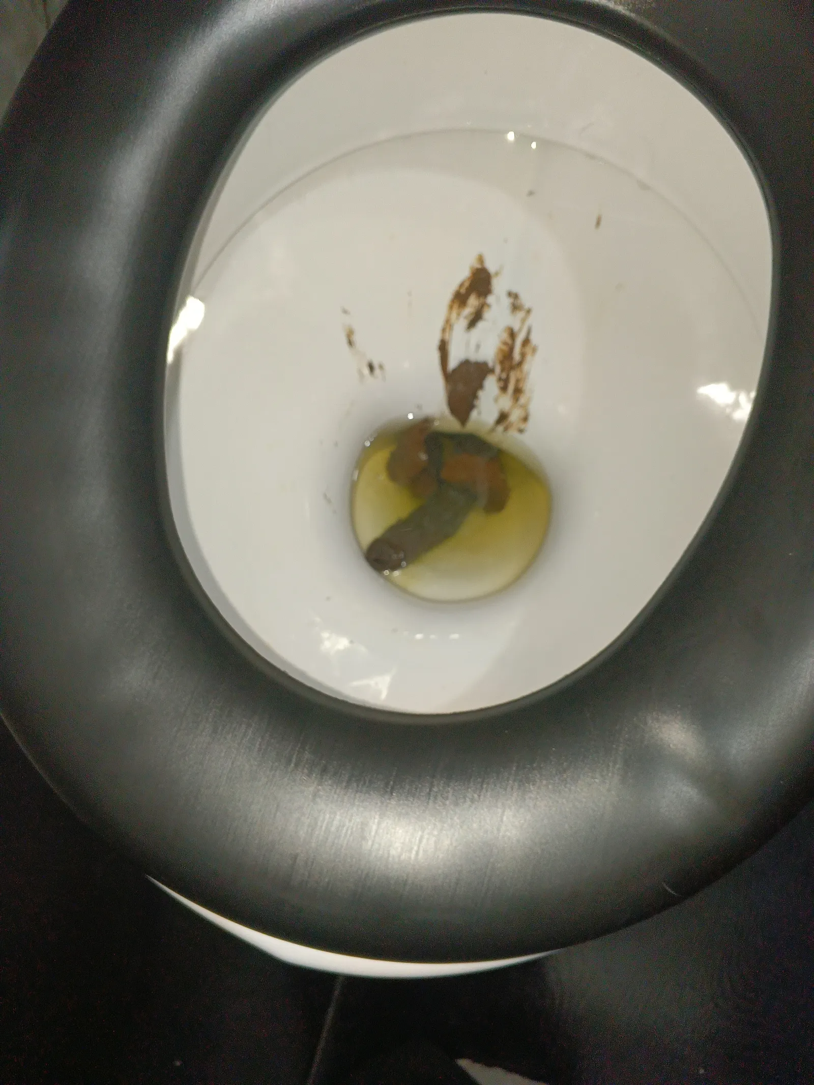 Me costó hacer caca