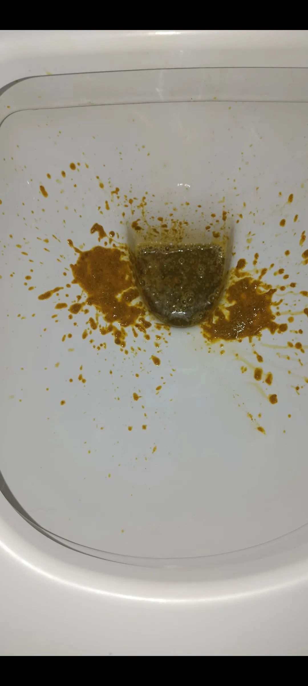 Not the best but felt like I was pissing out my arse.