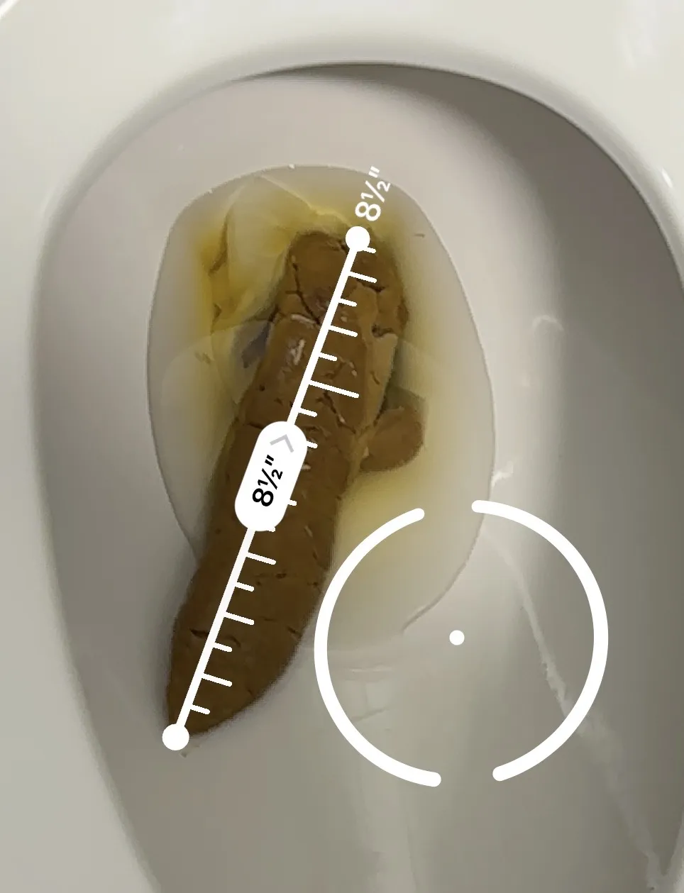 1st Poo Post Colonoscopy