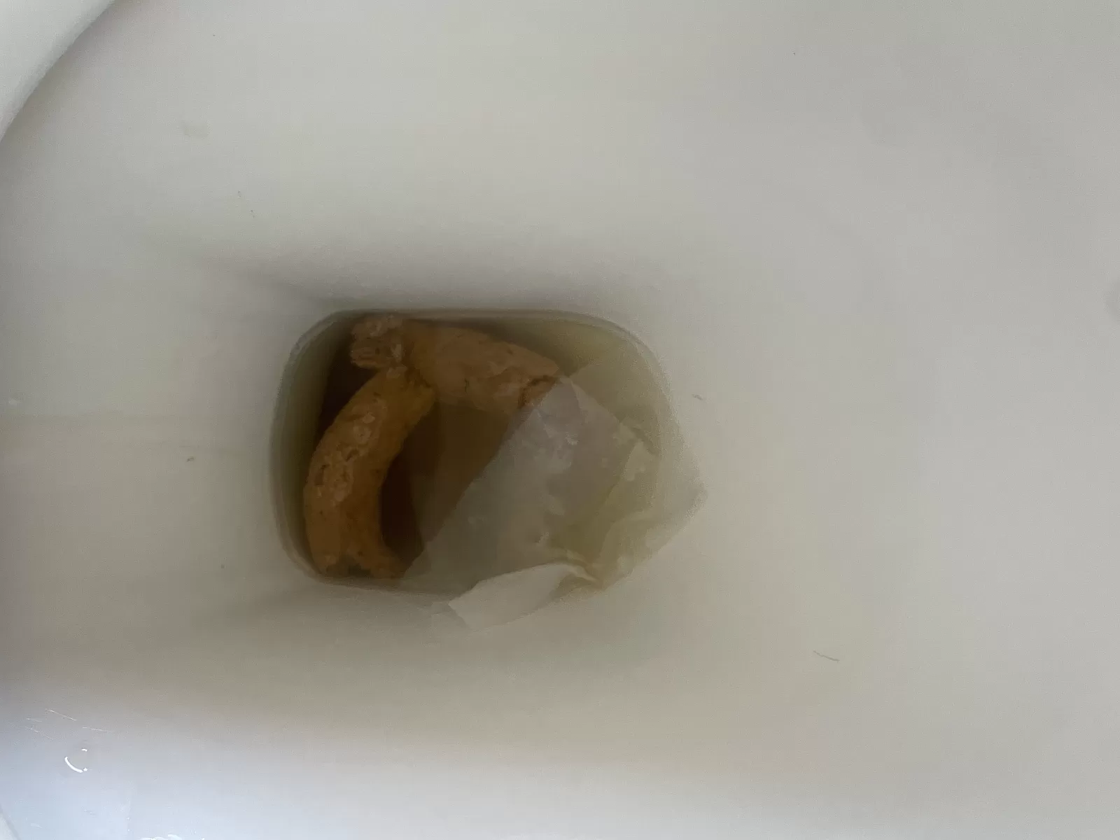 Normal Poop